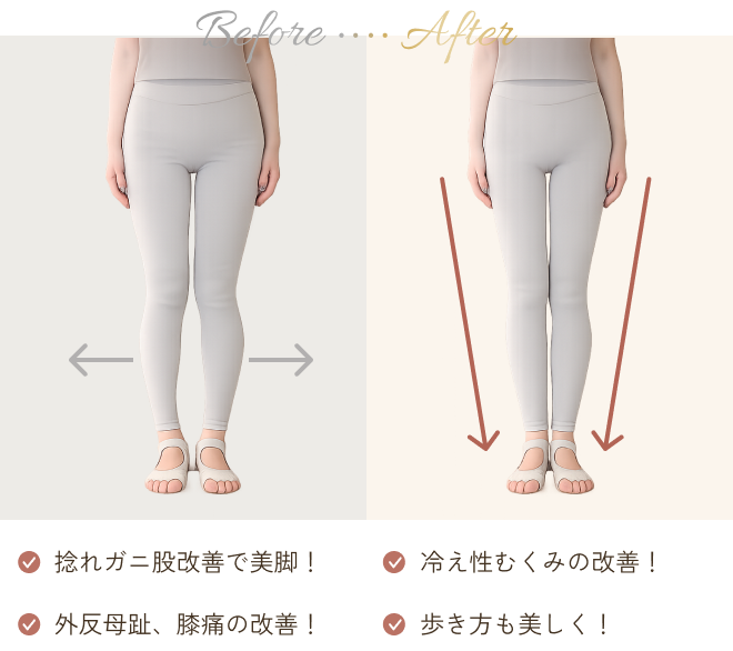 O脚